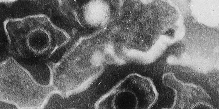 How Epstein-Barr Virus Evades the Immune System