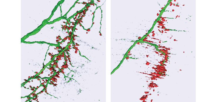 Learning More About How a microRNA is Involved in ALS