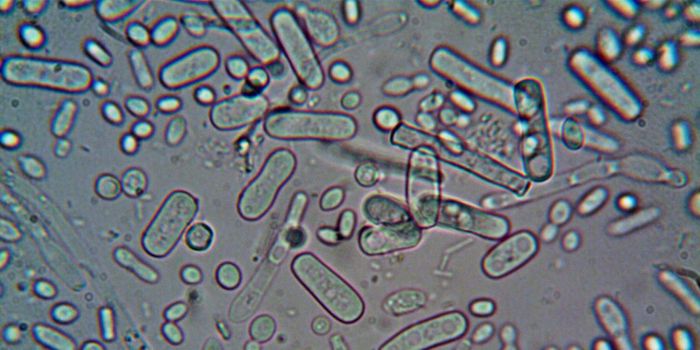 IBS Linked to Increased Incidence of Depression, Anxiety, Suicidal Ideation