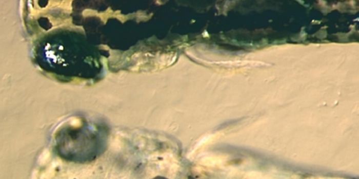 The Tiny Zebrafish is Helping With Concussion Research