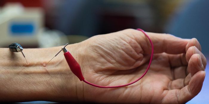 Is Acupuncture Effective or Not?