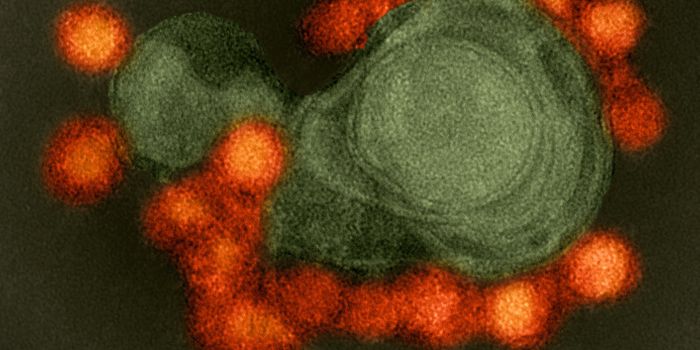 Learning How TORCH Pathogens Cause Brain Malformations