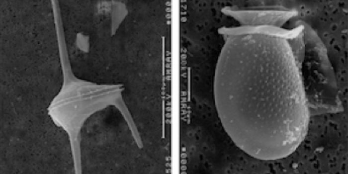 Towards an Understanding of Dinoflagellate Evolution