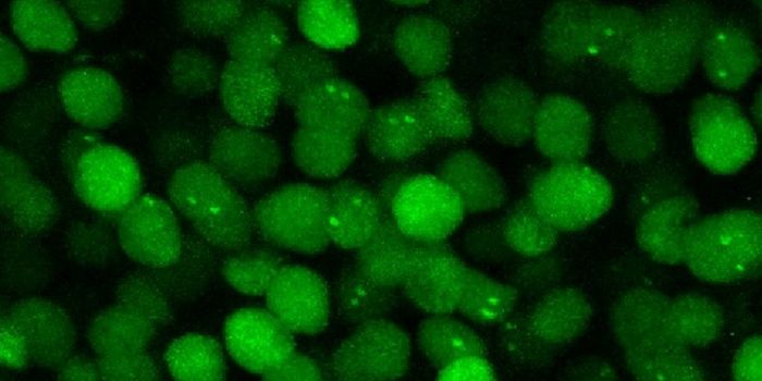 Observing Gene Expression in Real-Time in Live Mouse Brains