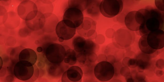 Is It Possible to Prevent Leukemia in Down Syndrome Patients?