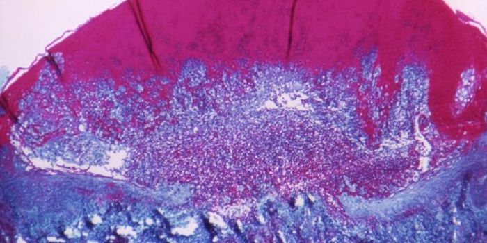 This Day in Science History - Edward Jenner & The Smallpox Vaccine