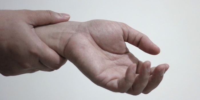 Newly Discovered Cell Type Predicts Arthritis Flares