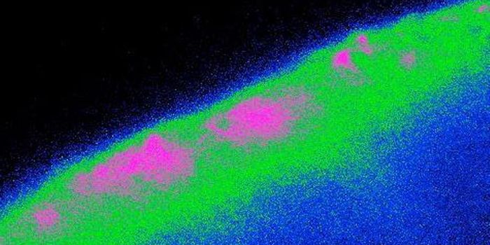 Cells in the Brain Found to Sense Food Intake