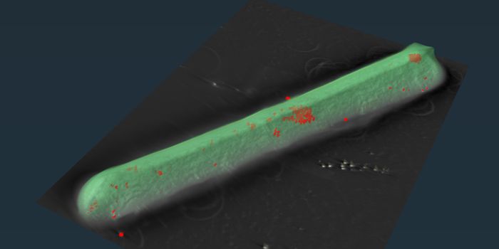 Previously Unknown Membrane-Bound Organelles Key to C. difficile's Iron Defense
