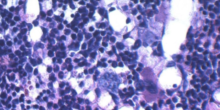 Obesity has a Lasting, Negative Impact on Blood-Making Cells