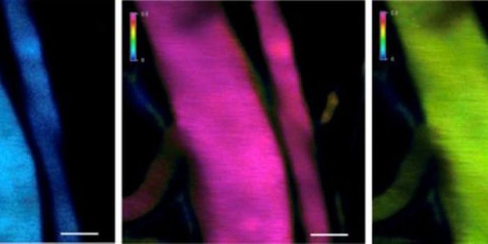 Nanomachine Improves Drug Delivery for Cancer Therapeutics