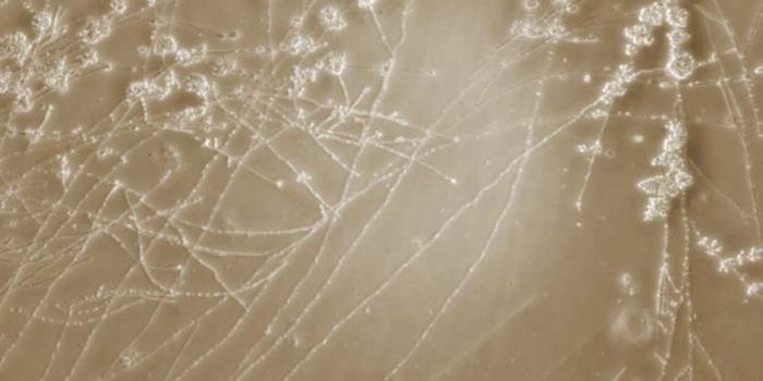 Fungi Can be a Healthy or Destructive Part of the Gut Microbiome