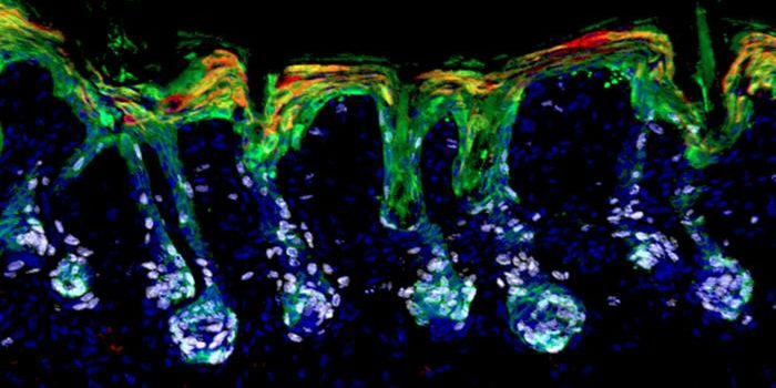 An Essential Role for Vitamin A in Wound Repair & Stem Cell Function