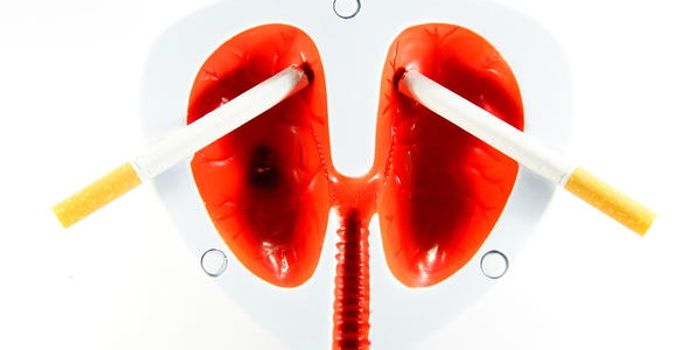 Finally Catching Small Cell Lung Cancer Before Metastasis