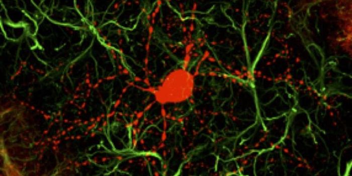 Treating Huntington's Disease With a Gene Therapy That Targets Brain Cells