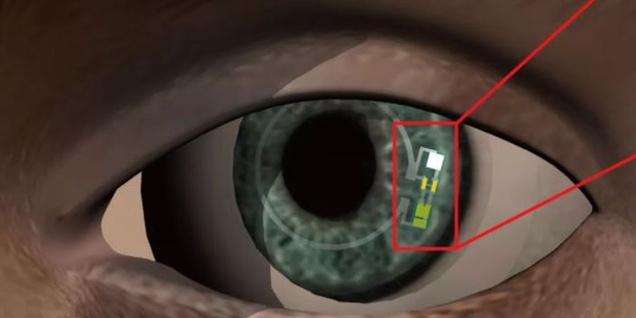Smart Contact Lens Aims to Measure Blood Sugar for Diabetics
