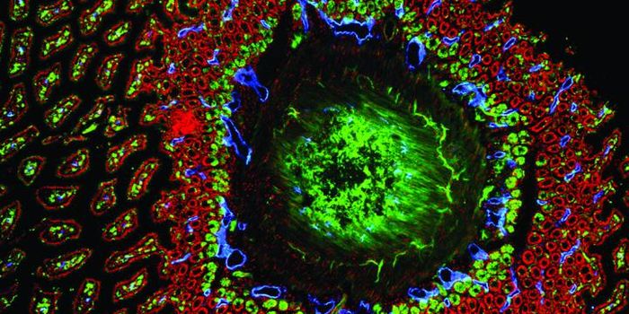 Gene Function now Revealed, Presents GI Cancer Drug Target