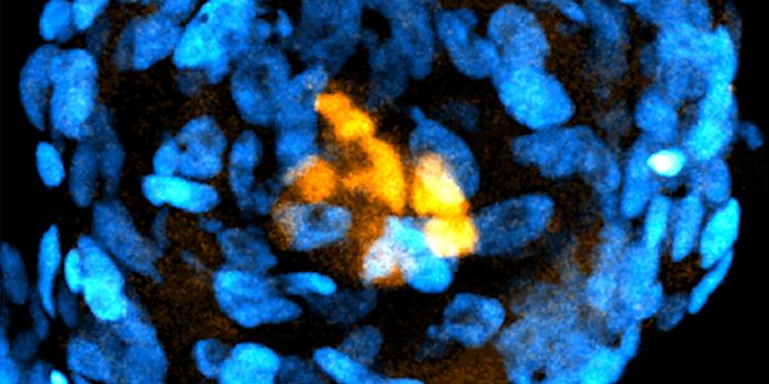 A Human Embryo Model is Made From Stem Cells