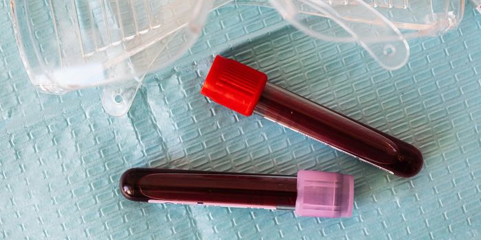 New Device Detects Cancer from Blood Sample