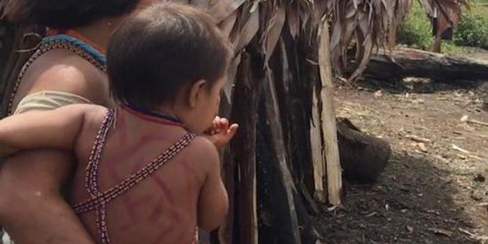 Major Diet Changes may Improve Microbiome Health, but Only in Kids