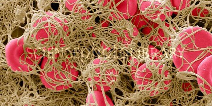 Surprising Discovery With Blood Clots and Bacteria