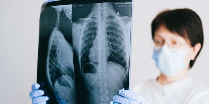 New "Dark-Field" X-ray Technology Improves Diagnostic Abilities for Pulmonary Conditions