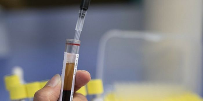A Blood Test to Diagnose Brain Injury