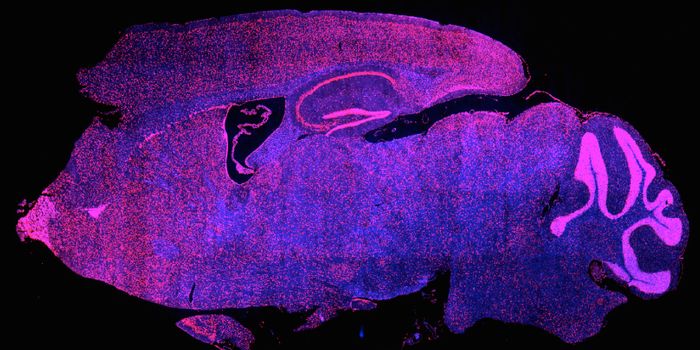 Diabetes Drug May Help Alcohol Addiction