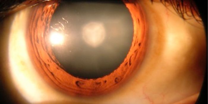 Native Stem Cells Regrow Human Lenses, Vision Restored