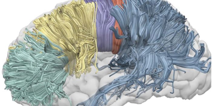 Fat Fibers Push Language Processing to the Left Hemisphere