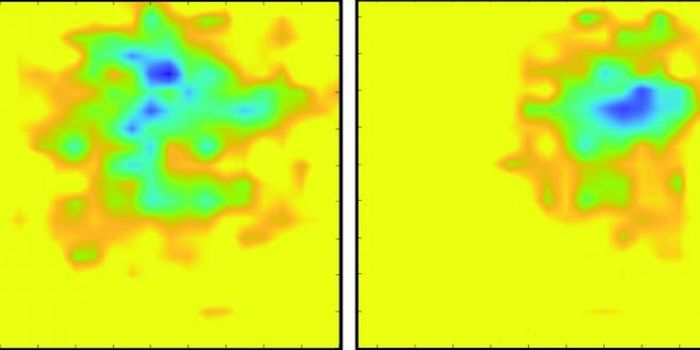 The Electricity of a Beating Heart is Caught on Graphene Camera