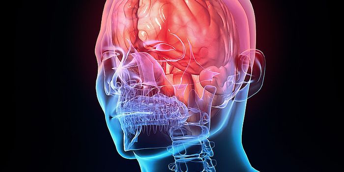 DNA Sequencing Enhances Brain Disease Diagnoses