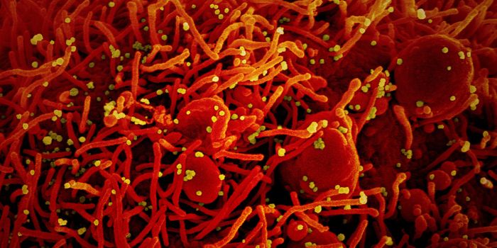 Daily Aspirin Users Less Likely to Die From COVID-19