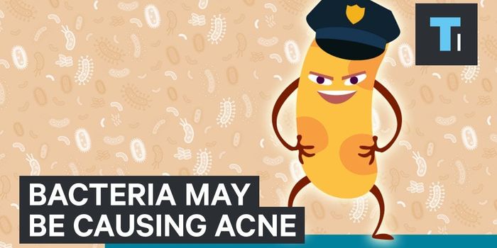 Different People Get Different Kinds of Acne, Here's Why