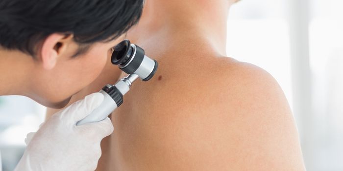Compound Blocks Melanoma Metastasis by 90 Percent
