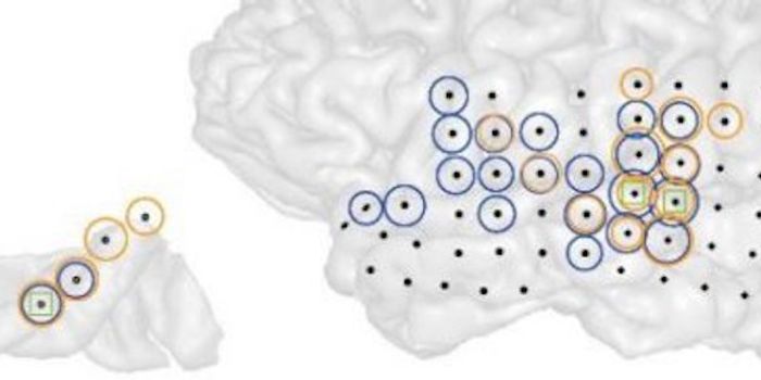 Researchers Record from Brain to Locate Tinnitus