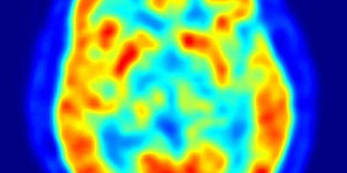 Common Meds and Brain Injury