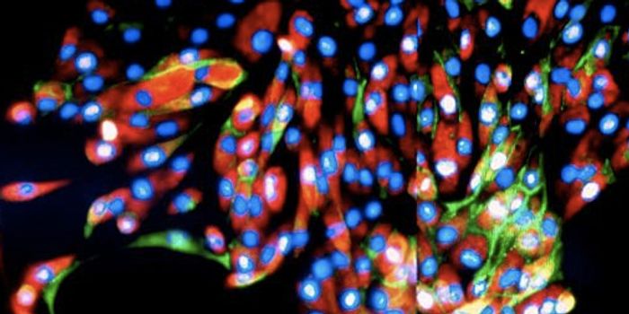 Stem Cells Successfully Deliver Therapeutics to Brain Cancer