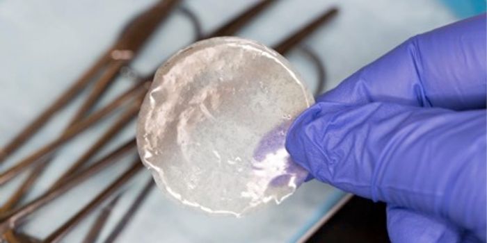 Implantable Film Shrinks Pancreatic Tumors In Mice