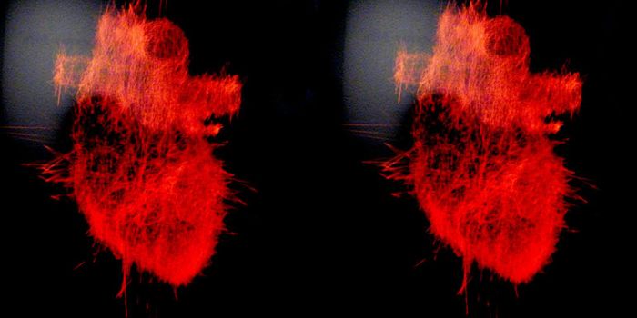 Virtual heart depicts deadly arrhythmias in 3D