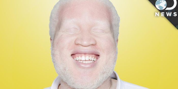 How does albinism work?