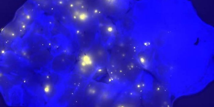 Immunotherapy: New Hope for Patients with Advanced Lung Cancer