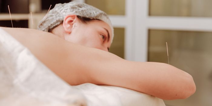 Acupuncture Can Help Control Cancer-Related Pain