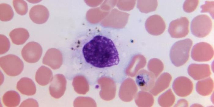 tRNA Plays a Role in the Immune Response to Stroke