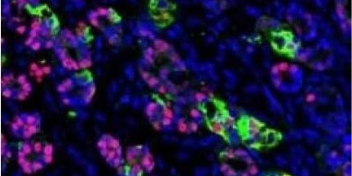 Science Transforms Skin Cells into Insulin-Producing Beta Cells