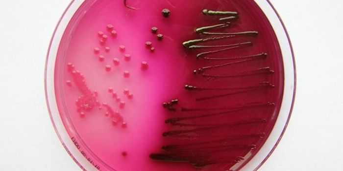 Reducing Antibiotic Use Isn't Enough to Stop Resistance