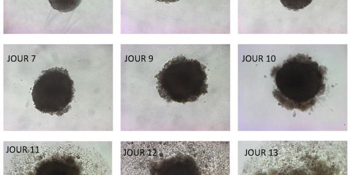 Can An Omega-3 Fatty Acid Destroy Tumors?