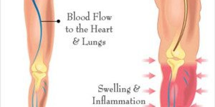 Technology better than tape measure for identifying lymphedema risk