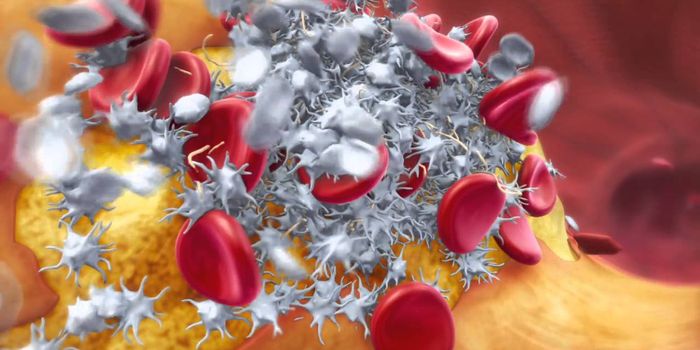 People with This Kind of Heart Disease At Higher Risk for Suicide