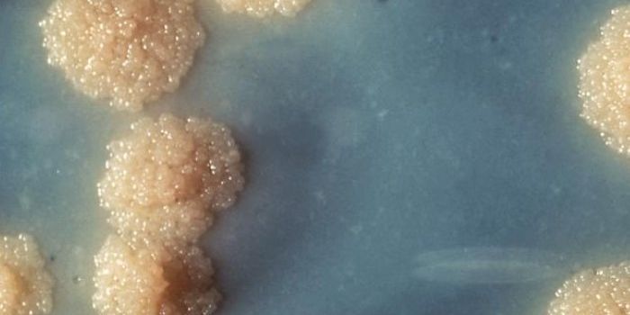 Scientists Use DNA Sequencing to Trace Spread of Drug Resistant TB